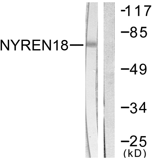 Anti-NYREN18 Antibody