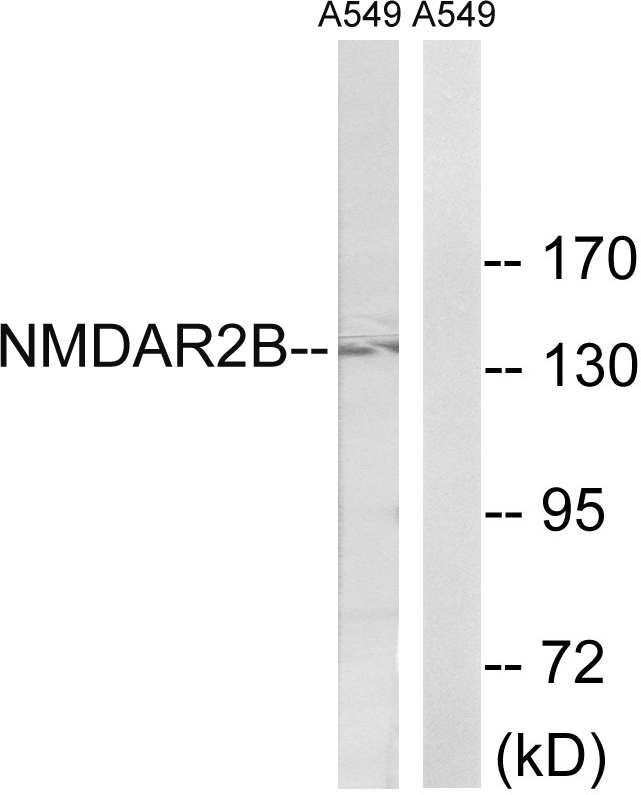 Anti-NMDAR2B Antibody