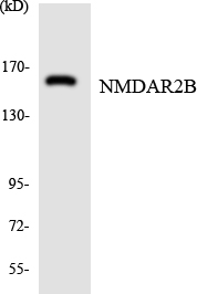 Anti-NMDAR2B Antibody