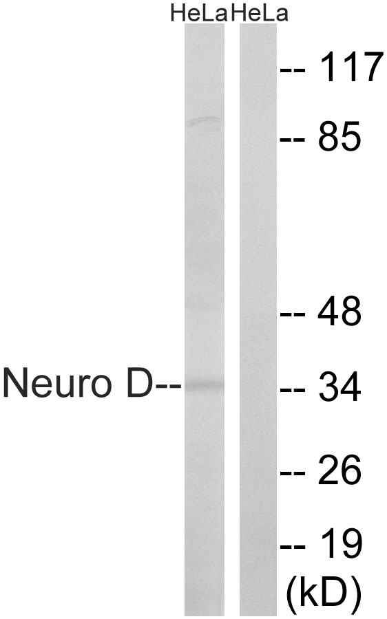 Anti-Neuro D Antibody