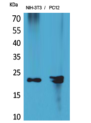 Anti-HDGFRP3 Antibody