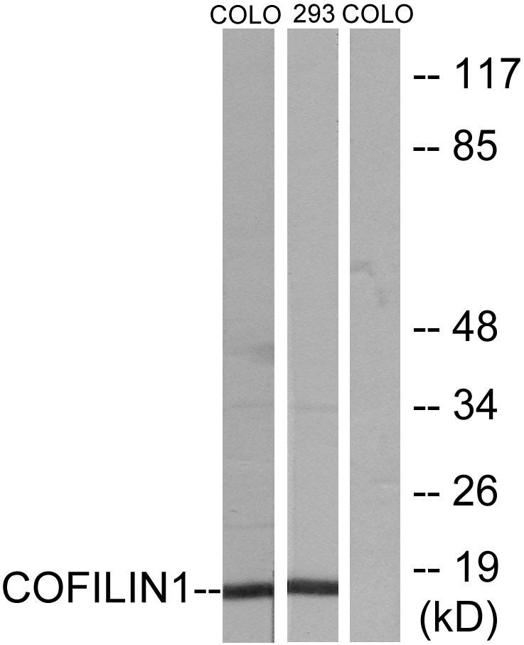 Anti-Cofilin Antibody
