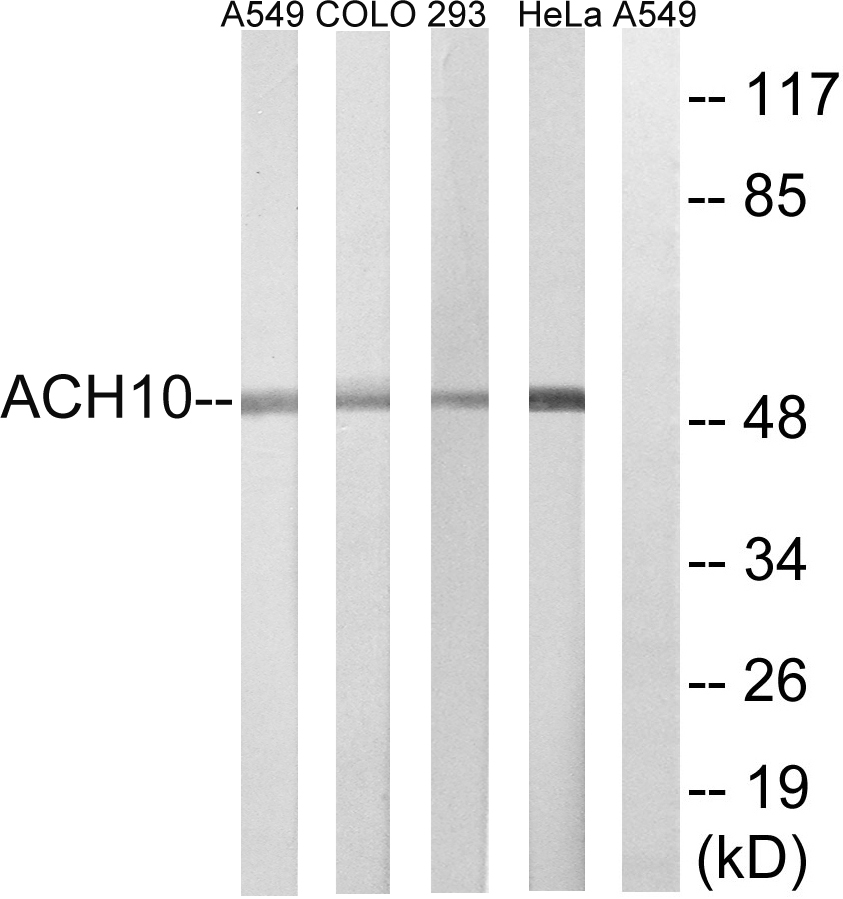 Anti-CHRNA10 Antibody
