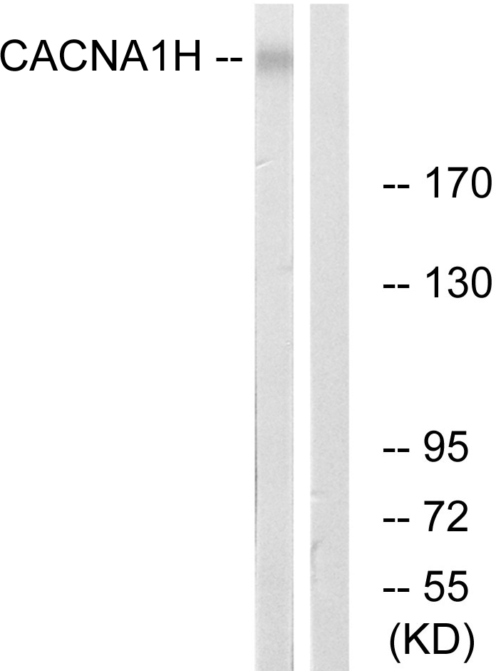 Anti-CACNA1H Antibody