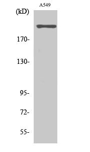 Anti-CACNA1H Antibody Anti-CACNA1H Antibody