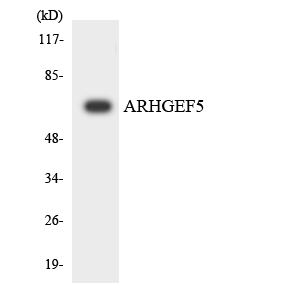 Anti-ARHGEF5 Antibody