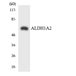 Anti-ALDH1A2 Antibody