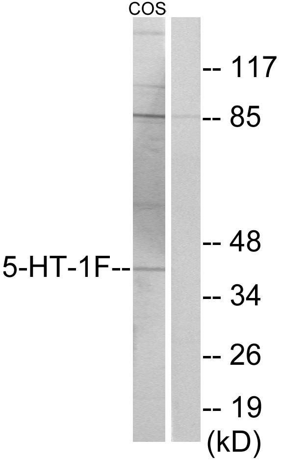 Anti-5-HT-1F Antibody