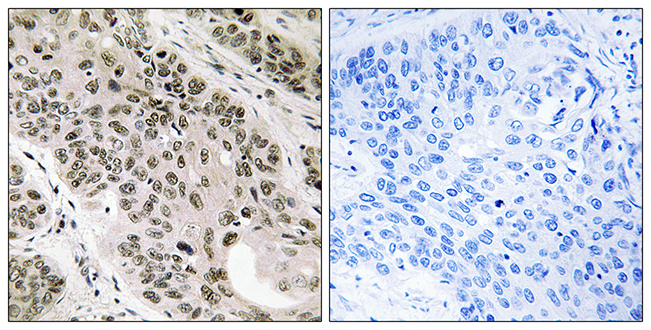 Anti-TNNI3K Antibody - Identical to Abcam (ab111140)