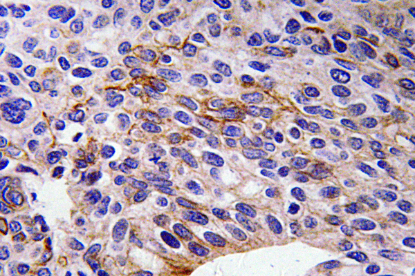 Anti-SEMA3A Antibody