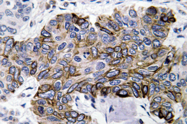 Anti-RANTES Antibody