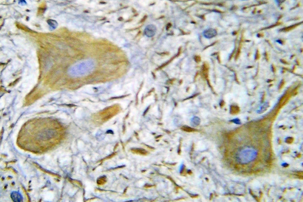 Anti-NMDAR1 Antibody