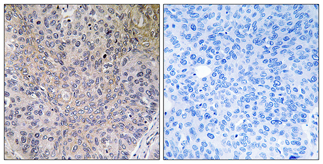 Anti-NDUFS7 Antibody