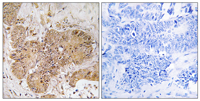 Anti-LUC7L2 Antibody