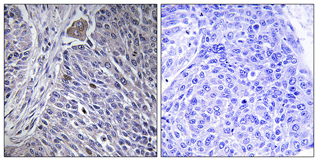 Anti-HNRPDL Antibody