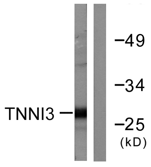 Anti-TNNI3 Antibody