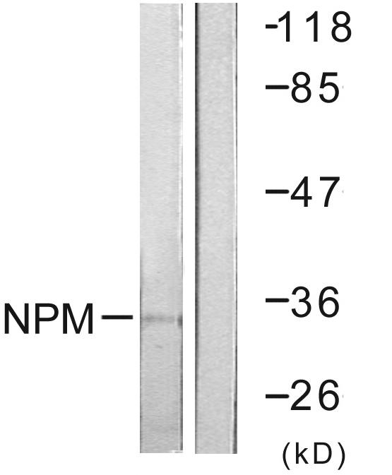 Anti-NPM Antibody Anti-NPM Antibody