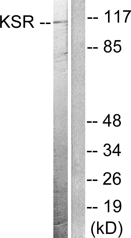 Anti-KSR Antibody