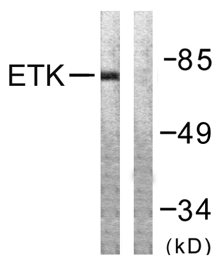 Anti-ETK Antibody