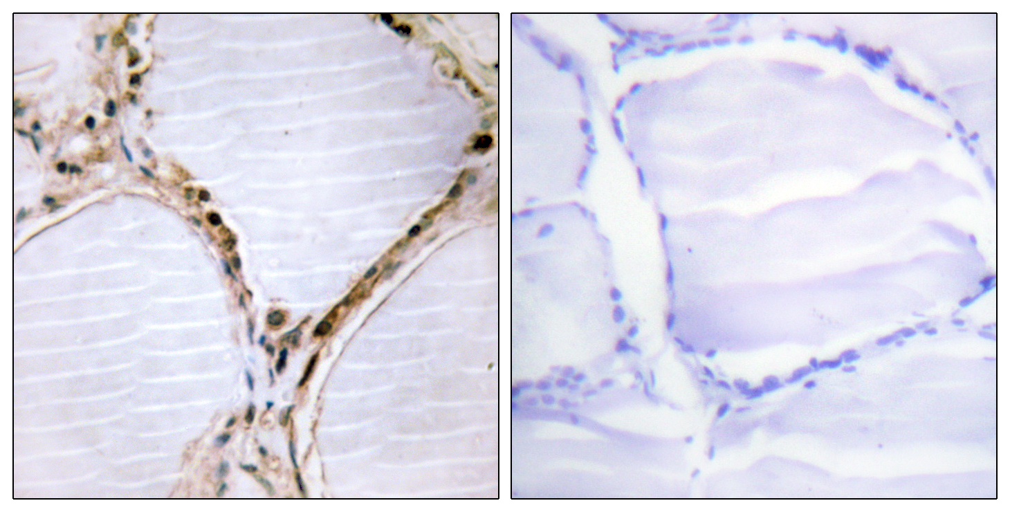 Anti-ETK Antibody Anti-ETK Antibody
