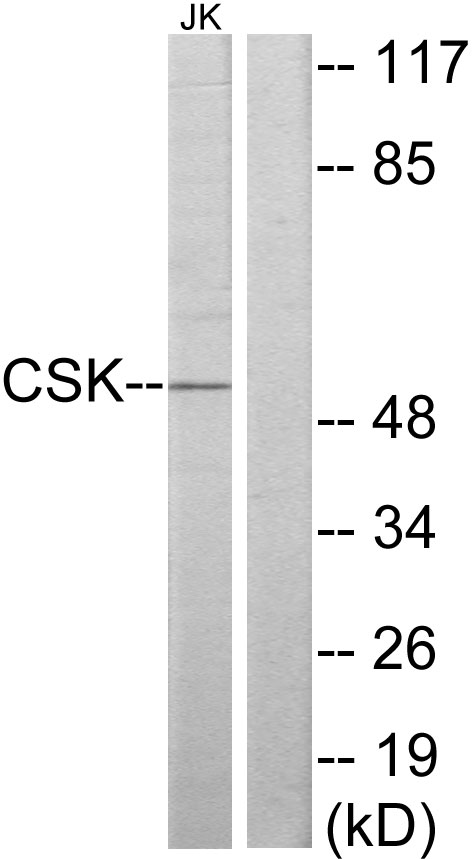 Anti-CSK Antibody