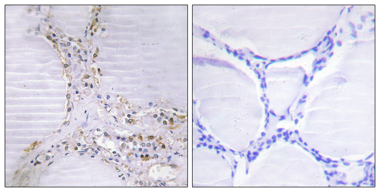 Anti-BMX Antibody Anti-BMX Antibody