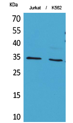 Anti-APE1 (acetyl Lys7) Antibody Anti-APE1 (acetyl Lys7) Antibody