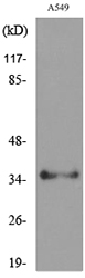 Anti-APE1 (acetyl Lys6) Antibody
