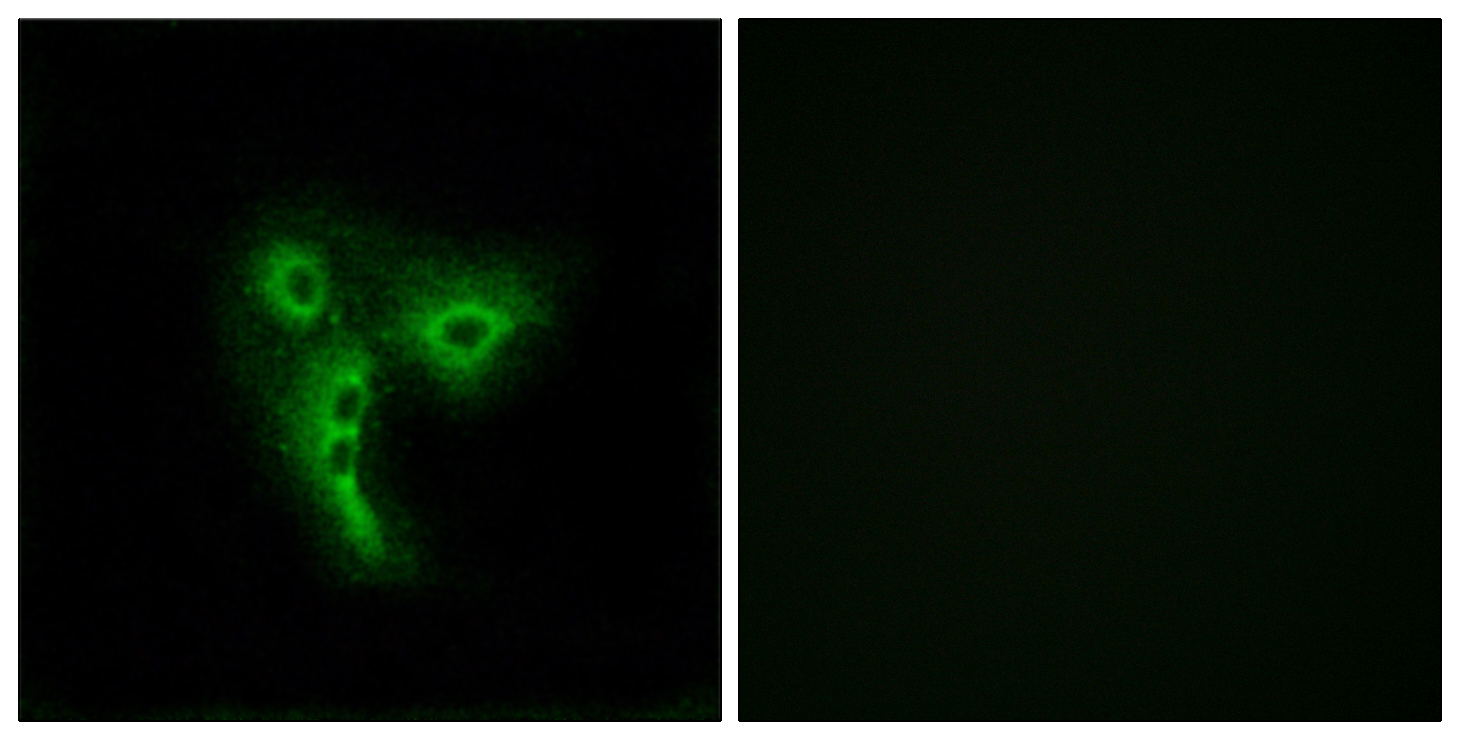 Anti-OR4A4 + OR4A47 Antibody