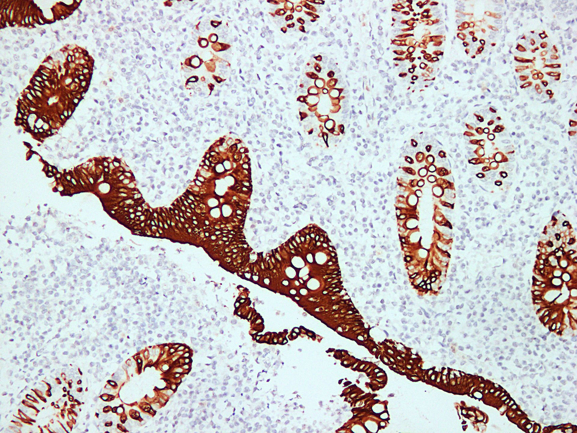 Anti-Cytokeratin 20 Antibody [ABT-Ck20]