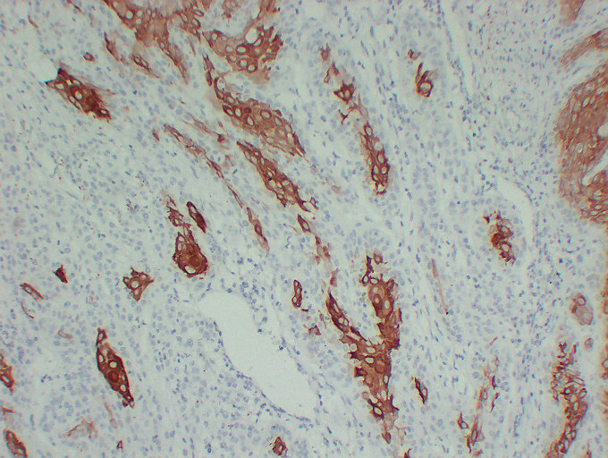Anti-Cytokeratin 16 Antibody [ABT-CK16]