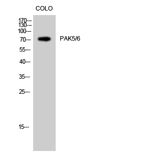 Anti-PAK5 + PAK6 Antibody