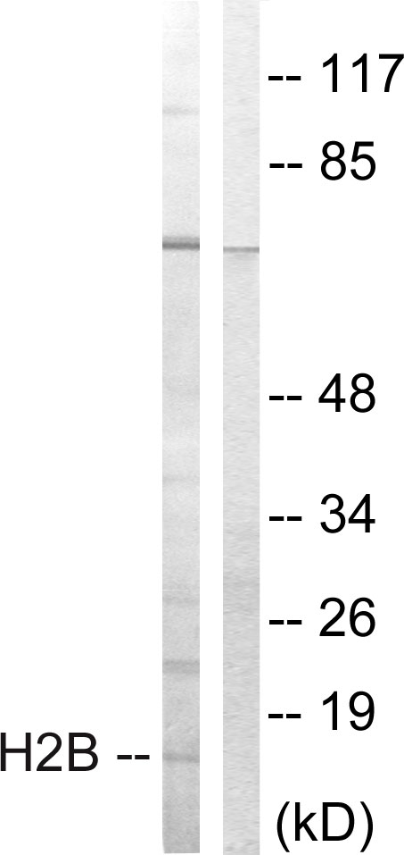Anti-Histone H2B Antibody