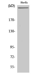 Anti-Factor VIII Antibody Anti-Factor VIII Antibody