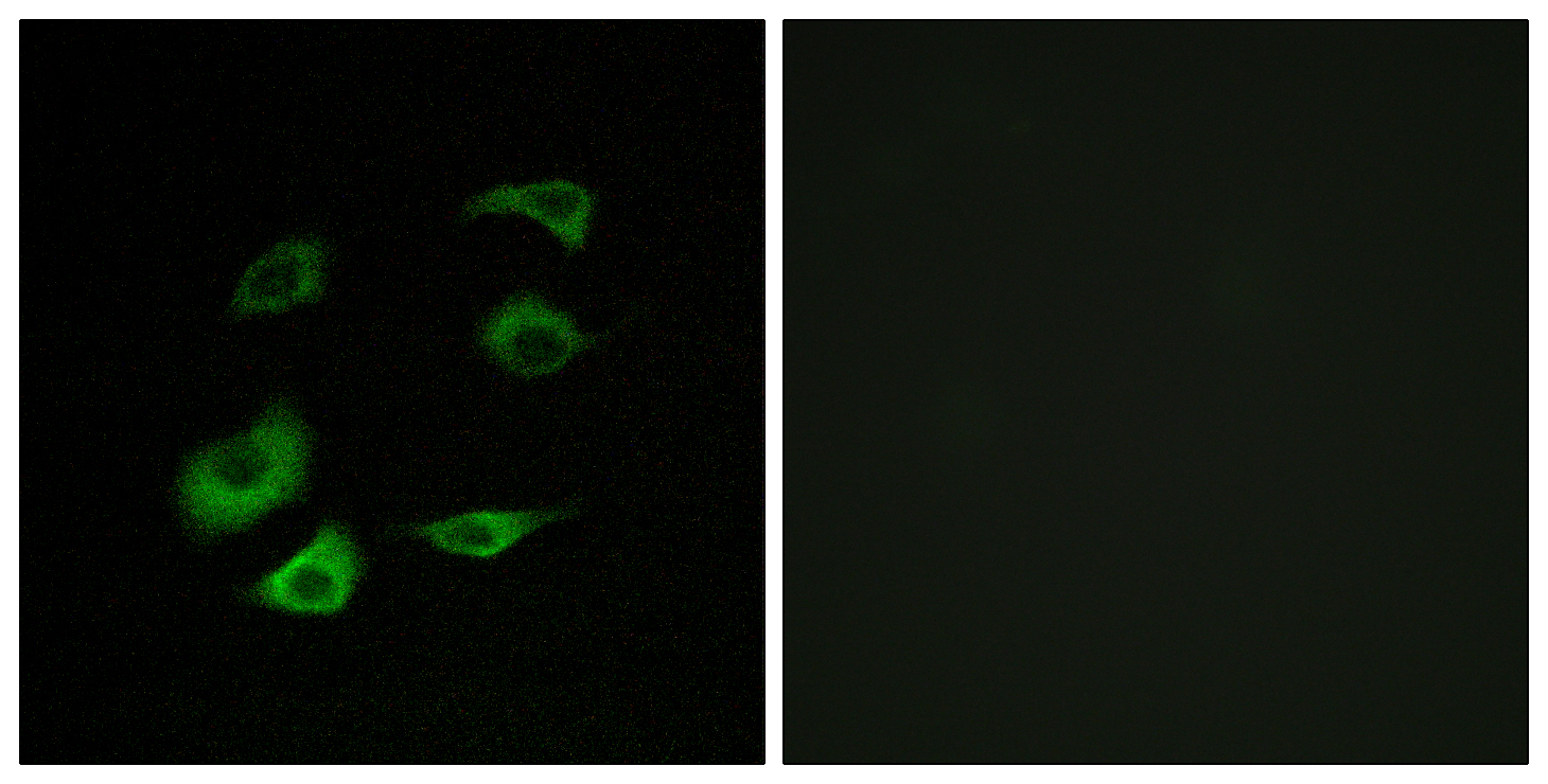 Anti-Cyclosome 1 Antibody