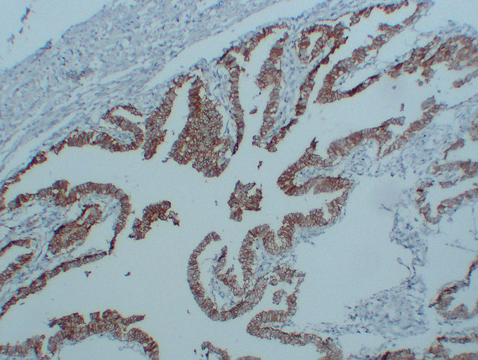 Anti-N Cadherin Antibody [ABT-CDH2]