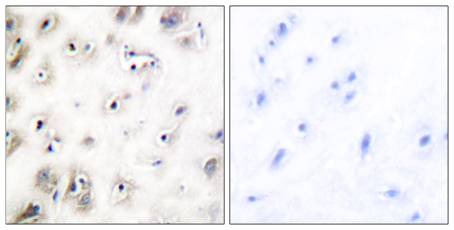 Anti-Amylin Antibody Anti-Amylin Antibody